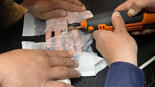 Parmağına sıkışan yüzüğü itfaiye çıkardı.